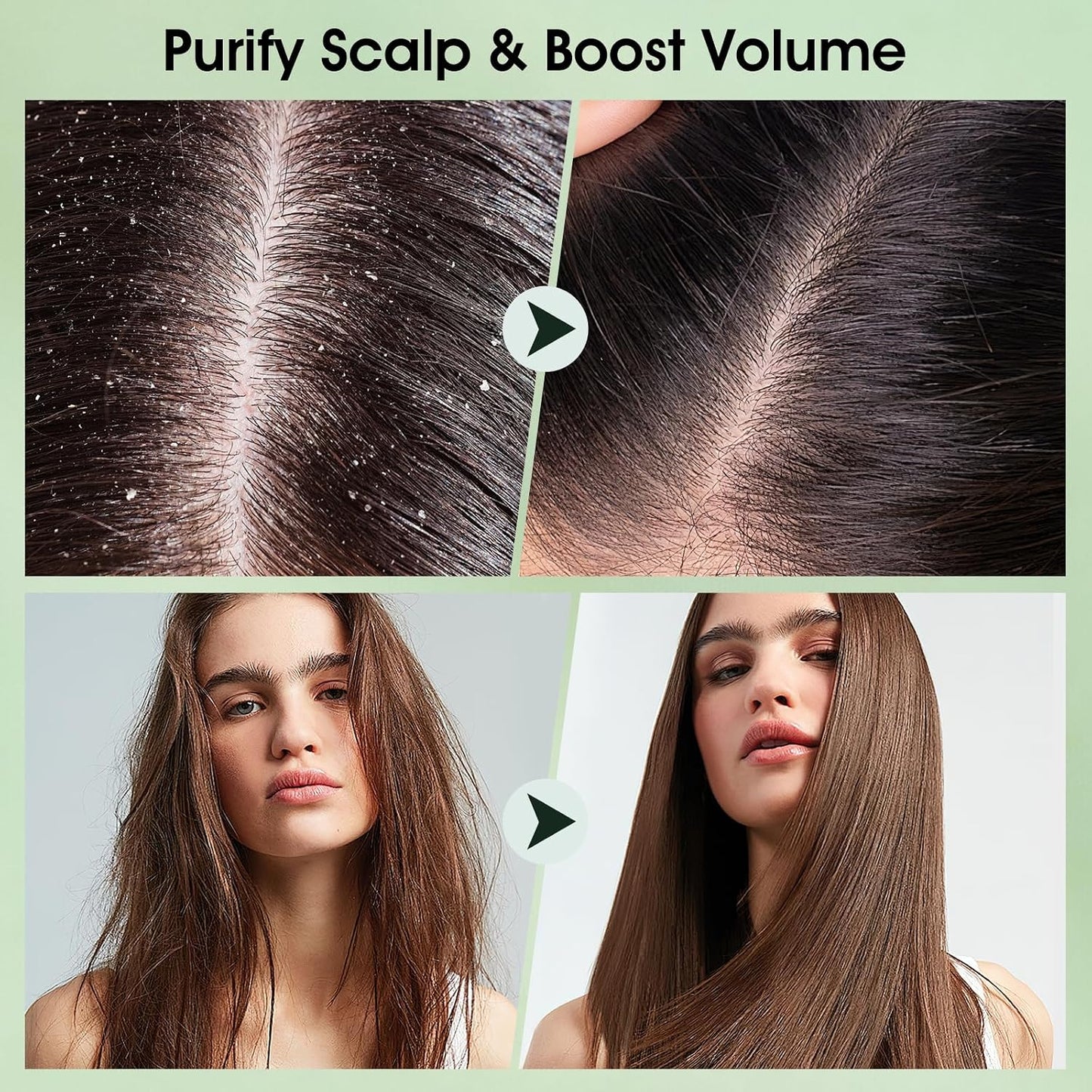 Scalp Scrub, Tea Tree Scalp Exfoliator Scrub Shampoo, 2-In-1 Scalp Treatment with Mint Oil, Hair Treatment to Clarify and Remove Build up with Silicone Scalp Massager, 10.6Oz/300G